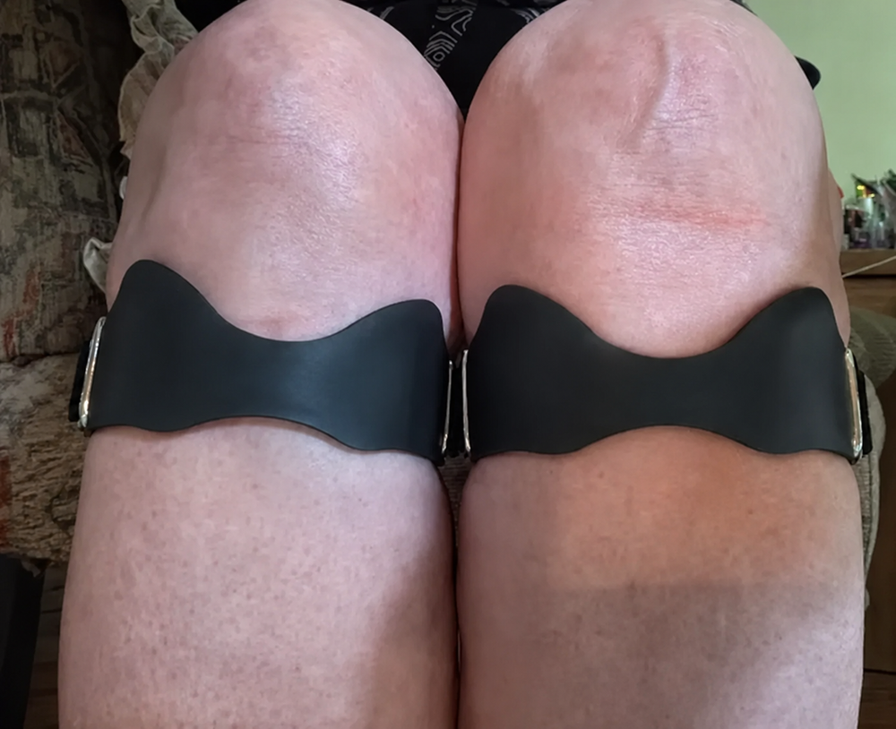 Foto compartida de dos soportes rotulianos Ortavio, sin logotipos visibles